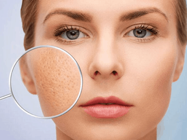 facial hair removal
