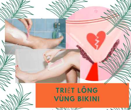 Bikini waxing, bikini hair removal