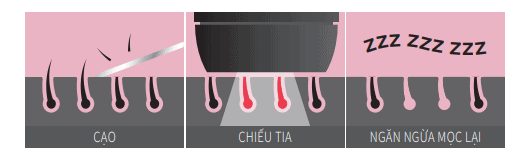IPL technology for hair removal and reducing underarm odor